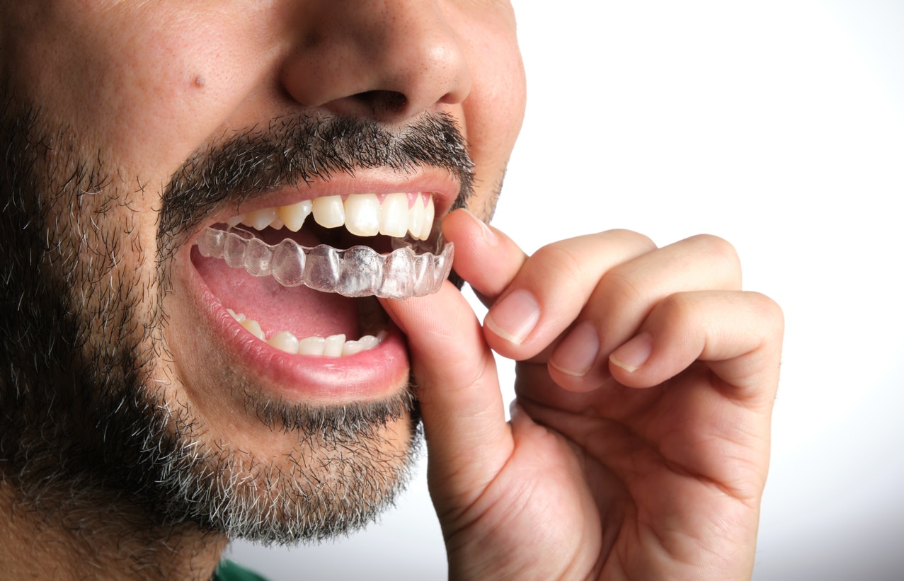 unrecognizable dark-haired man with beard putting on transparent dental retainer