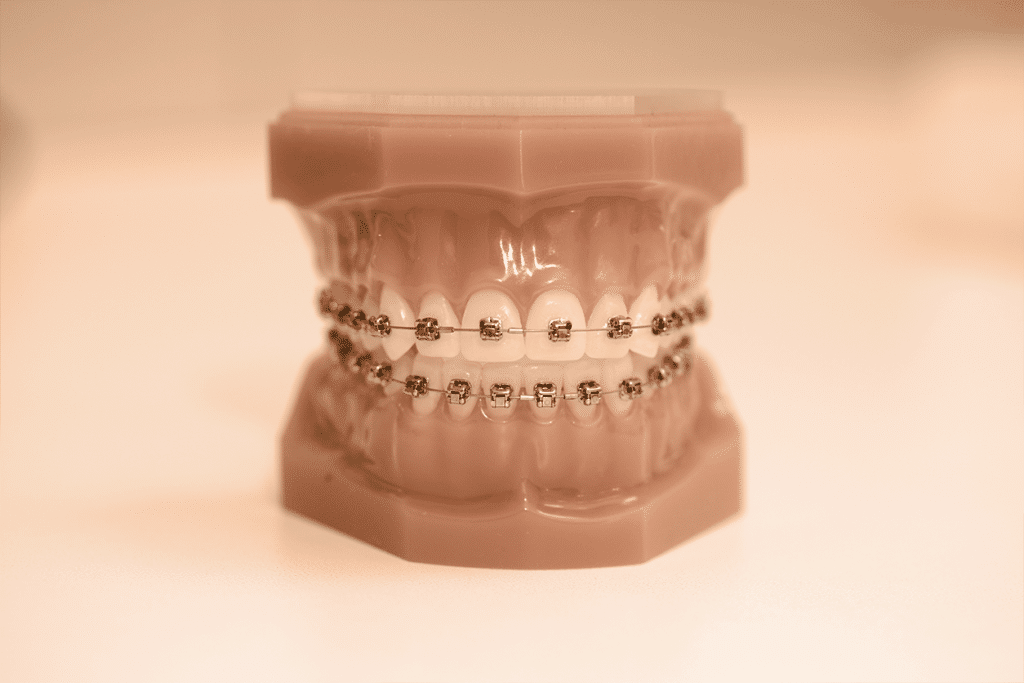 Clear Aligner Alternatives