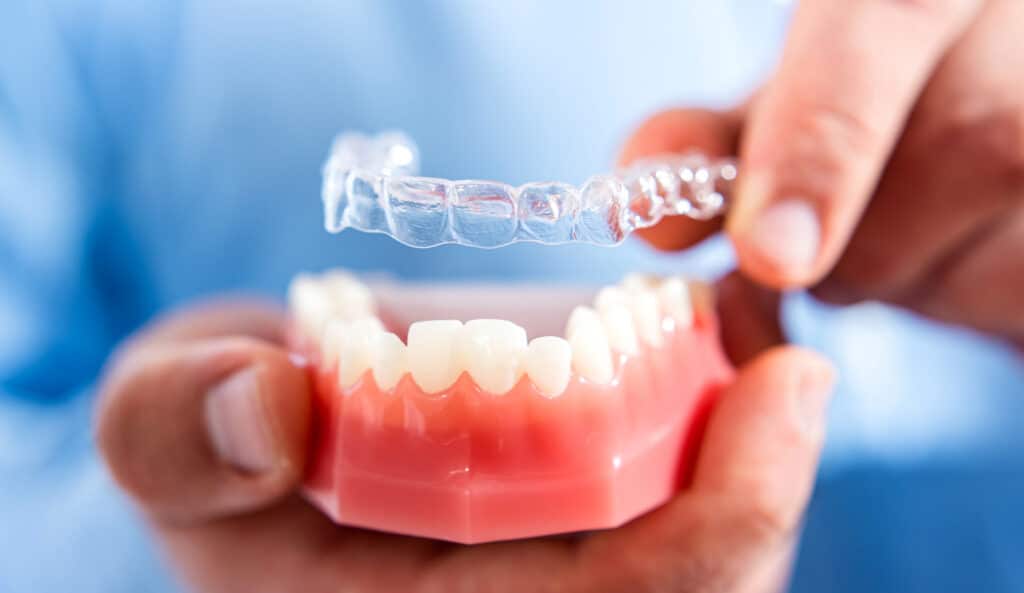 Close-up. The doctor puts transparent aligners on the teeth of the artificial jaw