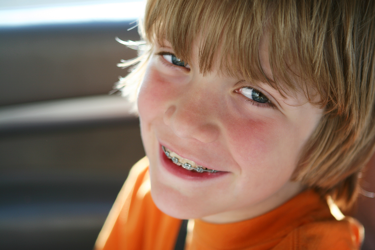 Close up Portrait of boy with braces in Pittsford, NY back lit from the summer sun. Shallow depth of field, focus on his eye.