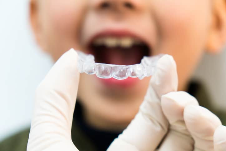 Clear Aligners for Kids